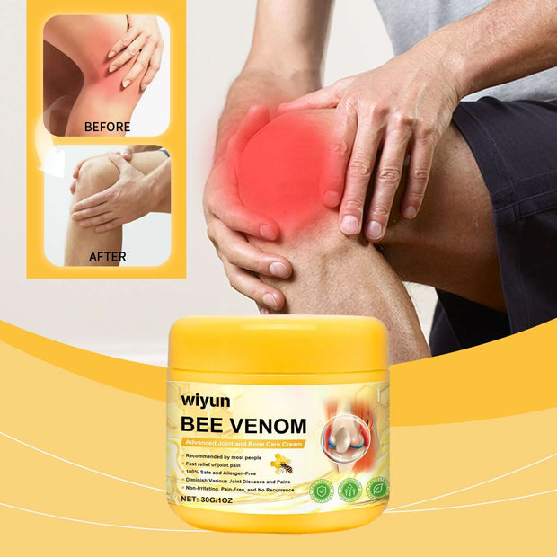 Crema reparadora de articulaciones Wiyun para muñecas y rodillas